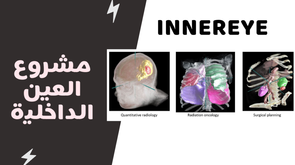 مشروع العين الداخلية