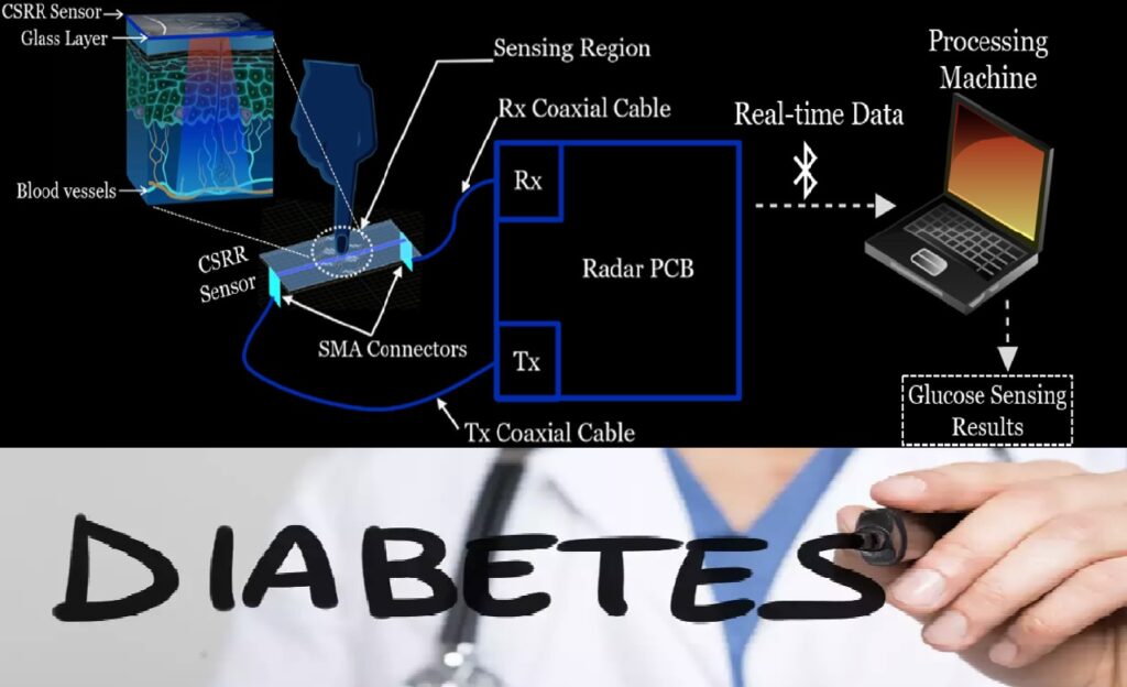 مراقبة السكر بالذكاء الاصطناعي و الرادار من خلال جهاز فحص جديد
