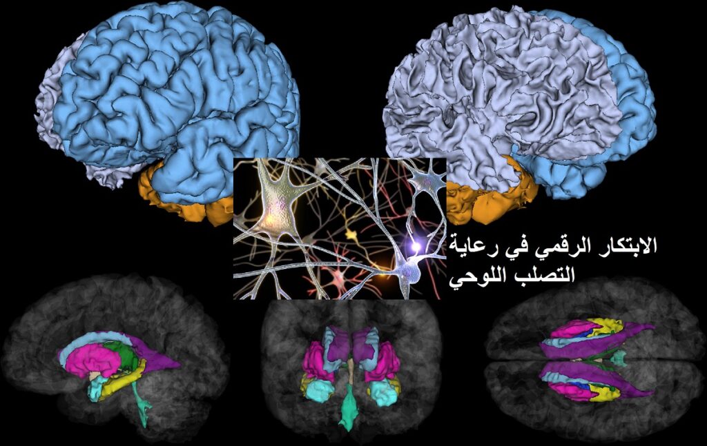 الابتكار الرقمي في رعاية التصلب اللوحي