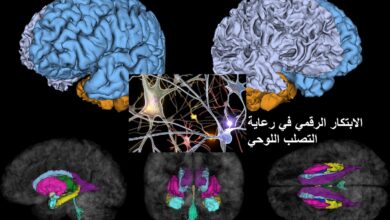 الابتكار الرقمي في رعاية التصلب اللوحي