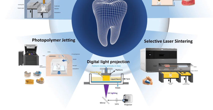 ثورة الطباعة ثلاثية الأبعاد في طب الأسنان