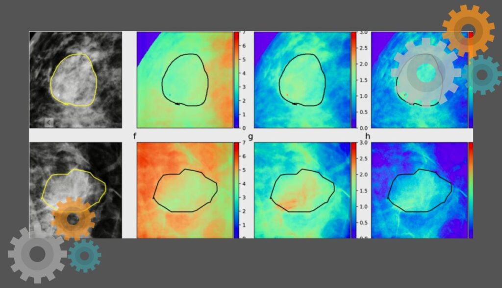 التعلم العميق للتنبؤ والكشف عن سرطان الثدي