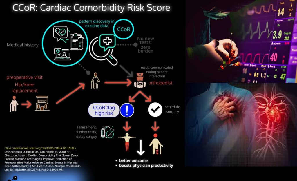 الذكاء الاصطناعي يتنبأ بحدوث مضاعفات قلبية بعد استبدال مفصل الورك