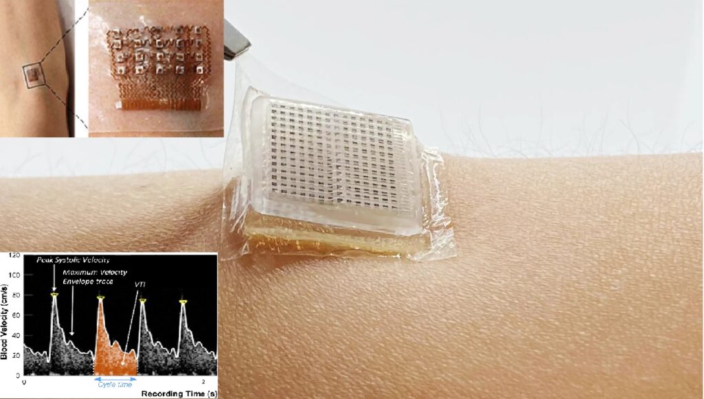 رقعة جلدية تعمل بالموجات فوق الصوتية تتيح مشاهدة دقات القلب